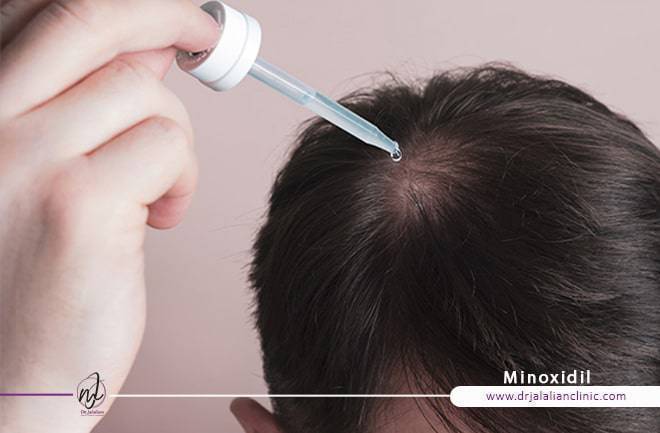 مزوتراپی مو چیست ؟